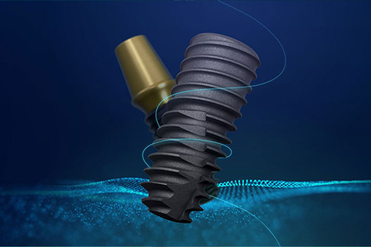 리스크 걱정 감소